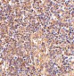 ATM Antibody